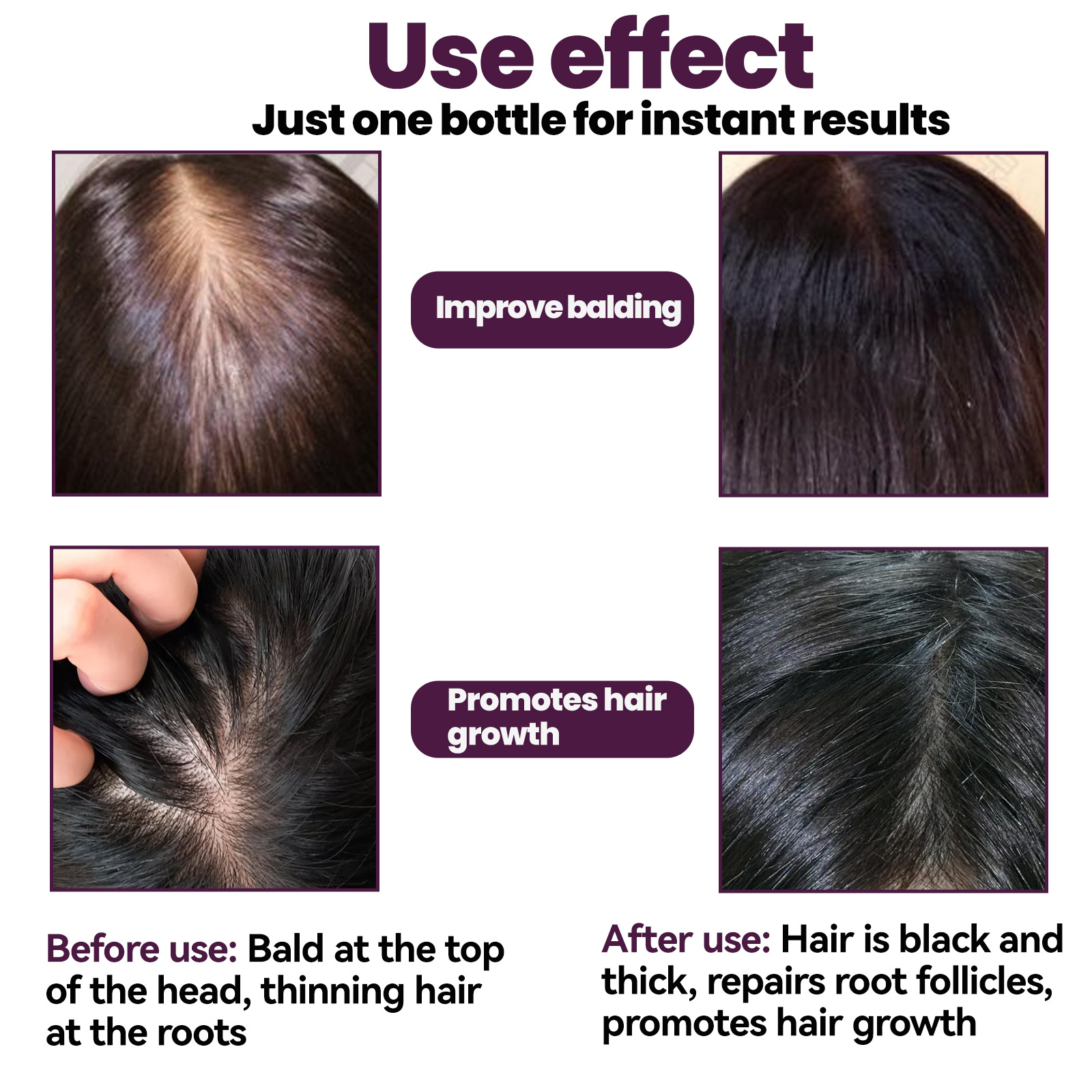 EELHOE Schaumpflege, kräftiges Haar, Anti-Tropfen-Stimulation, lange Follikel, Ernährung und Haarfixierung_voghion.com