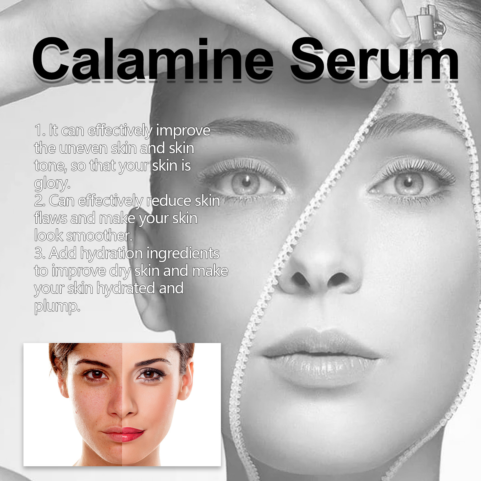 Esența facială de calamină Hoygi îmbunătățește uscăciunea, aspectul tern al pielii, acneea, hidratează și conferă volum pielii._voghion.com