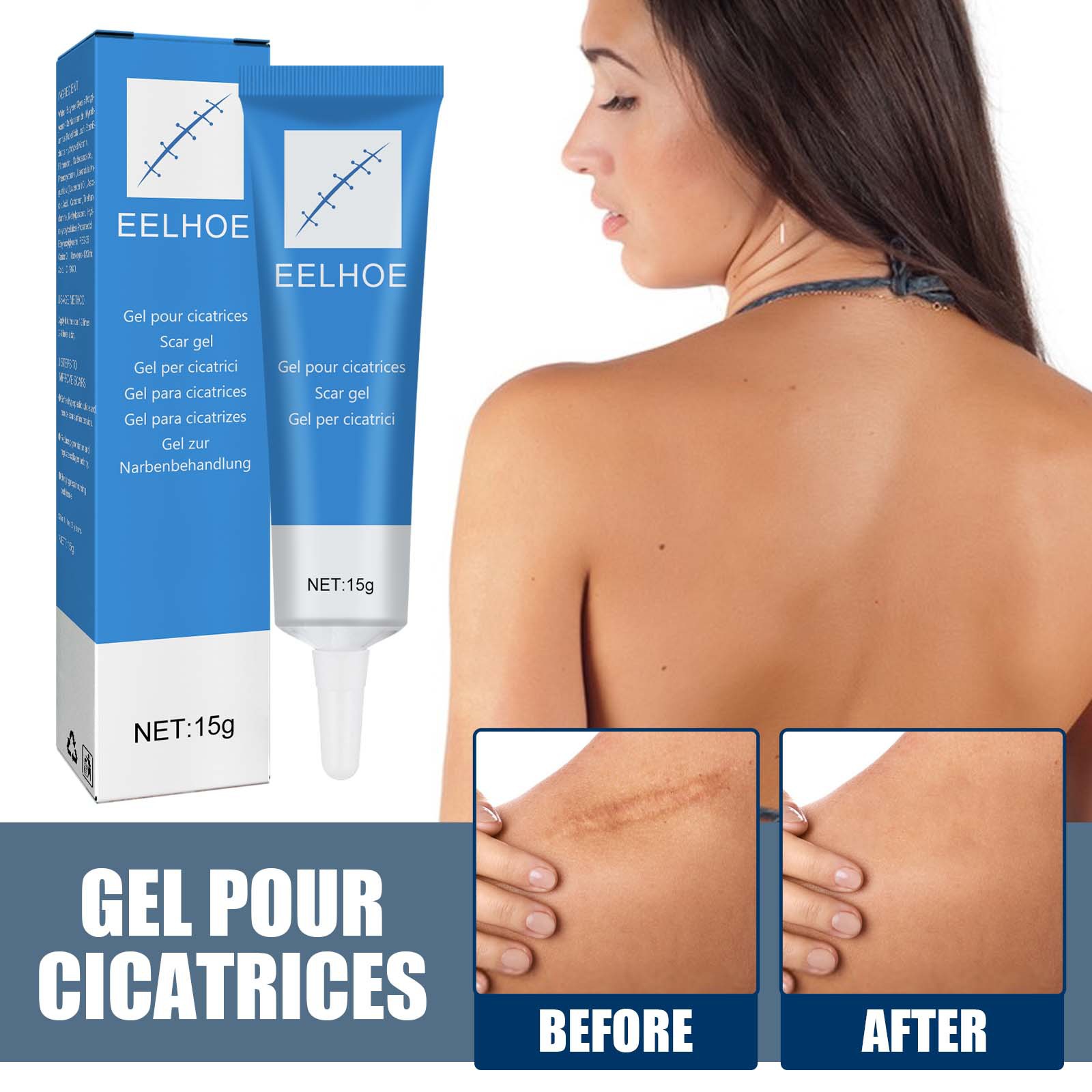 EELHOE scar gel external cold compress cream skin damage repair type softening, smoothing and moisturizing_voghion.com
